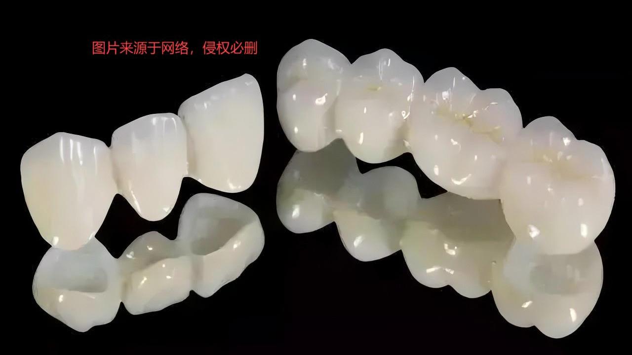 UV光固化设备在牙科产品的应用